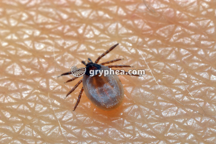 Tique sur la peau (Ixodes sp.) - gryphea.com